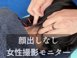 小顔美容鍼・首肩こり 山崎のエステ・リラクイメージ