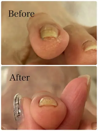 ネイル Alo.nail アロ•ネイルのネイルデザイン