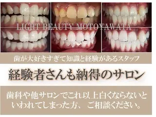 五十嵐 蓮のその他イメージ