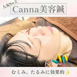 福岡/天神/大名 【美容鍼】森原拓磨のエステ・リラクイメージ