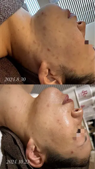 salonda mahinaのエステ・リラクイメージ