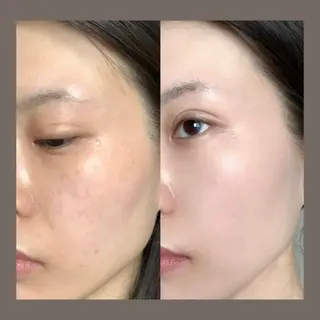 愛維美水光美肌専門店 メンズレディースokのエステ・リラクイメージ