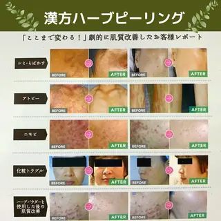 よもぎ蒸しサロン ゆんのエステ・リラクイメージ