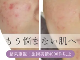 エステサロン NICOLIのエステ・リラクイメージ