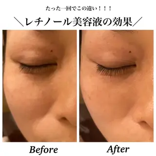 Bellesthe (ベルエステ)のエステ・リラクイメージ