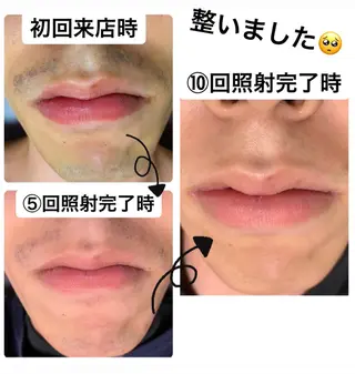 メンズ脱毛サロン Le falcoのエステ・リラクイメージ