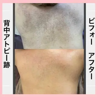 ハーブピーリング 専門店Kikkaのエステ・リラクイメージ