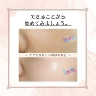 マツエク・マツパ 愛維美水光美肌専門店 メンズレディースokのエステ・リラクイメージ