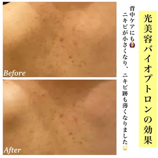 Bellesthe (ベルエステ)のエステ・リラクイメージ