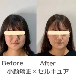 巻き肩・猫背矯正 小顔 espoirのエステ・リラクイメージ