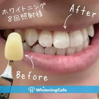 メンズ ホワイトニング カフェ川越店のエステ・リラクイメージ