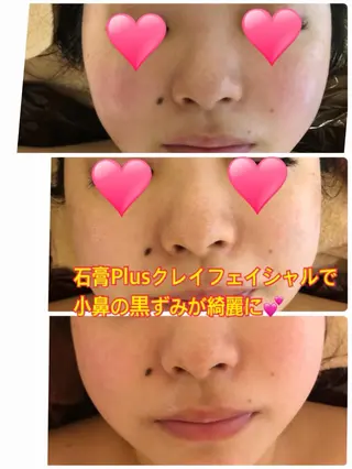 ❤️予約殺到❤️mi オールハンド痩身専門のエステ・リラクイメージ