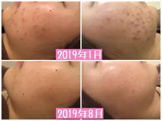 ショート カラー パーマ ヘアアレンジ メンズ キッズ ネイル マツエク・マツパ ニキビ・肌質改善専門 ♡人生が変わるサロンのエステ・リラクイメージ