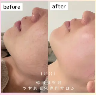 【エステサロン】 ichi aoiのエステ・リラクイメージ