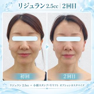 小顔痩身HALO 二宮早織のエステ・リラクイメージ