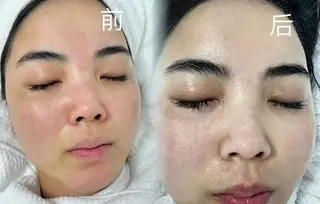 ネイル 愛維美水光専門店 川崎彩鳳のエステ・リラクイメージ