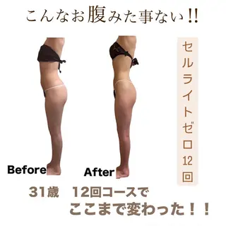 Vi's CLUB KOTONOのエステ・リラクイメージ