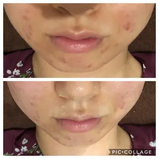 ロング カラー パーマ ヘアアレンジ キッズ ネイル マツエク・マツパ EnsorClair 代表 野口真央のエステ・リラクイメージ