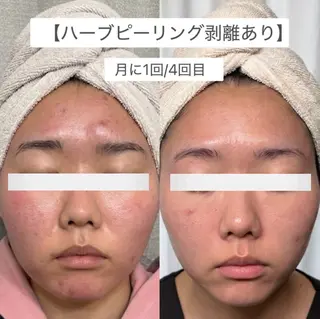 stella 柴山のエステ・リラクイメージ