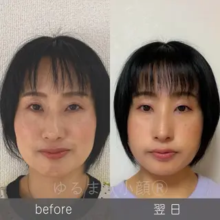 小顔矯正サロン町田 逸見智美のエステ・リラクイメージ