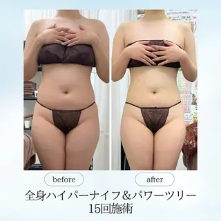 《痩身、小顔専門店》 エスプレッソのエステ・リラクイメージ