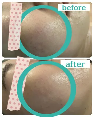 LUANA 美肌脱毛+Skinのエステ・リラクイメージ