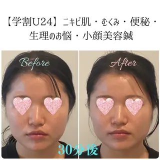 美容鍼&温活・免活 さくらんぼ鍼灸院のエステ・リラクイメージ
