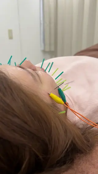美容鍼×肩甲骨はがし ×猫背×肩こり×整体のエステ・リラクイメージ
