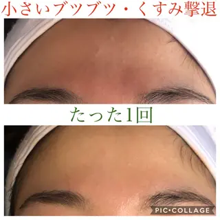 セミロング カラー パーマ ヘアアレンジ キッズ ネイル マツエク・マツパ EnsorClair 代表 野口真央のエステ・リラクイメージ