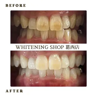 メンズ ホワイトニング ショップ葛西店のその他イメージ