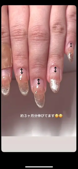 ネイル ミルフィーユ /Tomoeのネイルデザイン