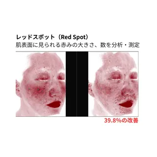 東三国/新大阪 敏感肌×小顔サロンのエステ・リラクイメージ