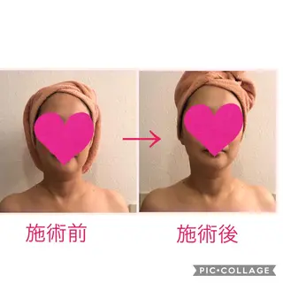 伊藤 順子のエステ・リラクイメージ
