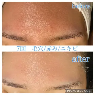 ショート カラー パーマ ヘアアレンジ メンズ ネイル マツエク・マツパ EnsorClair 代表 野口真央のエステ・リラクイメージ