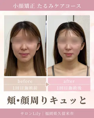 小顔矯正サロン Lilyのエステ・リラクイメージ