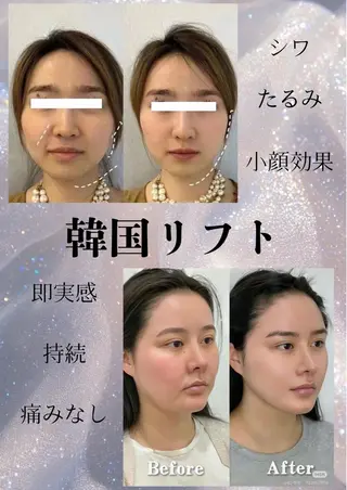 マツエク・マツパ 愛維美水光専門店 川崎彩鳳のエステ・リラクイメージ
