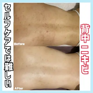 オールハンド専門🤍 痩身/小顔/ ハーブのエステ・リラクイメージ