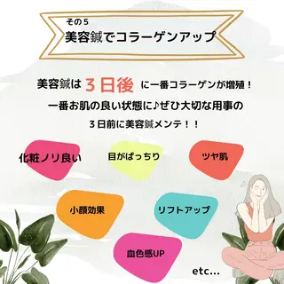 肌質改善美容鍼 ×ハーブピーリングのエステ・リラクイメージ