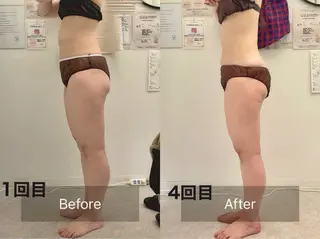 salon ray 痩身／体質改善のエステ・リラクイメージ