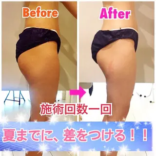 ショート カラー パーマ ヘアアレンジ メンズ キッズ ネイル マツエク・マツパ 痩身&ボディ 結果出し🌟丹野のエステ・リラクイメージ