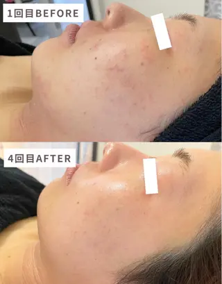 肌ケアサロン🌿 lapeca 土井のエステ・リラクイメージ