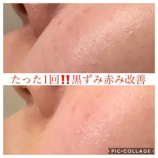 セミロング カラー パーマ ヘアアレンジ キッズ ネイル マツエク・マツパ EnsorClair 代表 野口真央のエステ・リラクイメージ