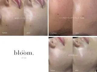 blöom. yuiのエステ・リラクイメージ