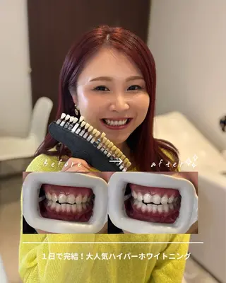 歯科提携エラン ホワイトニング一社店のその他イメージ