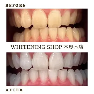 メンズ ホワイトニング ショップ本厚木のその他イメージ