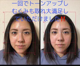 やはた 鍼灸整骨院のエステ・リラクイメージ