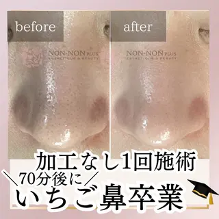 NON-NONプラス 大人の本気痩身のエステ・リラクイメージ