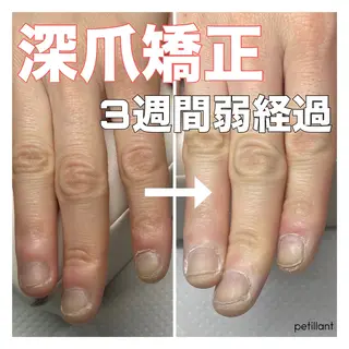 ネイル nail salon petillantのネイルデザイン