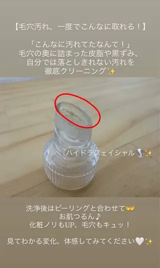 肌質改善サロン réposのその他イメージ