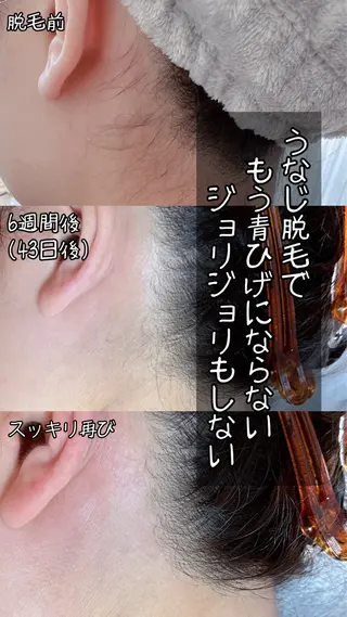 豊橋 |Hitomi シュガーリング専門店のその他イメージ